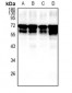 Anti-Fetuin A Antibody