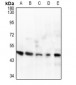 Anti-IL-1R2 Antibody