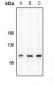 Anti-CD167a (pY792) Antibody