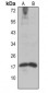 Anti-Histone H2A (AcK9) Antibody
