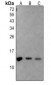 Anti-Histone H2A (AcK5) Antibody