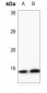 Anti-Histone H4 (DiMethyl-K20) Antibody