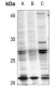 Anti-RAB21 (AcK109) Antibody
