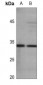 Anti-Aquaporin 3 Antibody