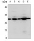 Anti-PDGFB Antibody