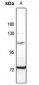 Anti-MID1 Antibody