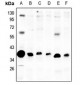 Anti-mPR alpha Antibody