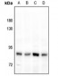 Anti-FAP alpha Antibody