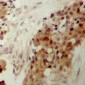 Anti-p38 (pY182) Antibody