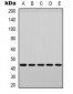 Anti-p38 (pY182) Antibody