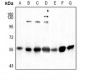 Anti-SGK1 Antibody