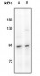 Anti-Glucocorticoid Receptor Antibody