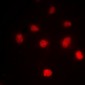 Anti-Histone H4 (AcK5) Antibody