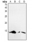 Anti-Histone H4 (AcK5) Antibody