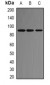 Anti-ACE2 Antibody