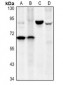 Anti-CD127 Antibody