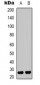 Anti-HMGB1 (AcK12) Antibody