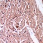 Anti-VEGFA Antibody