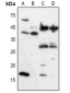 Anti-VEGFA Antibody