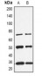 Anti-CALB1 Antibody