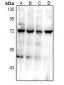 Anti-CD112 Antibody