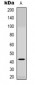 Anti-CCR6 Antibody