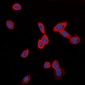Anti-GPR126 Antibody