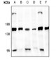 Anti-GPR126 Antibody