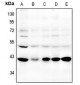 Anti-GPR87 Antibody