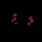 Anti-NPY5R Antibody