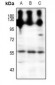 Anti-NPY5R Antibody