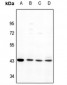 Anti-GPR170 Antibody