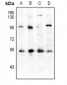 Anti-HNF4 alpha Antibody