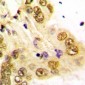 Anti-GATA5 Antibody