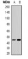 Anti-GATA5 Antibody