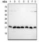 Anti-EIF5A2 Antibody