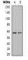 Anti-Pyruvate Kinase Antibody