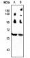 Anti-Beclin-1 Antibody