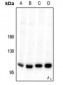 Anti-VPS34 Antibody