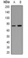 Anti-CD93 Antibody