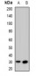 Anti-CD273 Antibody