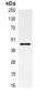 Anti-Alpha-actin-1 Antibody