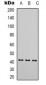 Anti-Alpha-actin-1 Antibody