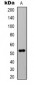 Anti-Alpha-tubulin (AcK40) Antibody