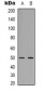 Anti-Beta2A-tubulin Antibody