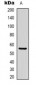 Anti-Beta-tubulin Antibody-HRP labled