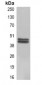 Anti-Carbonic Anhydrase 9 Antibody Antibody