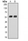 Anti-Carbonic Anhydrase 9 Antibody Antibody