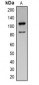 Anti-Cleaved PARP1 Antibody