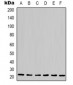 Anti-Cyclophilin B Antibody